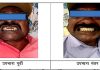 जिल्हा सामान्य रुग्णालयात आता दातांवर उत्कृष्ट उपचार