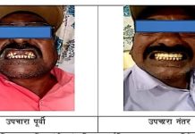 जिल्हा सामान्य रुग्णालयात आता दातांवर उत्कृष्ट उपचार