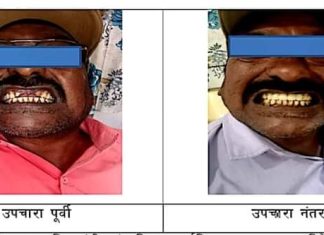 जिल्हा सामान्य रुग्णालयात आता दातांवर उत्कृष्ट उपचार